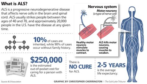 Amyotrophic Lateral Sclerosis From Diagnosis To Treatment
