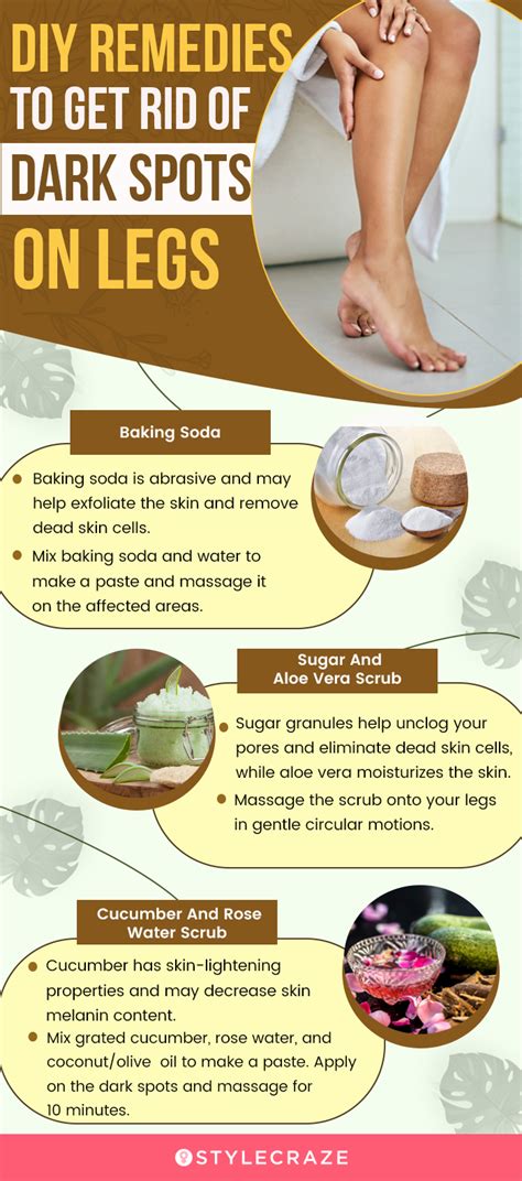 Dark Spots On Legs Causes Diy Home Remedies And Treatment