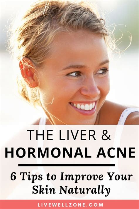 Liver And Hormonal Acne 6 Tips To Improve Your Skin Naturally Liver