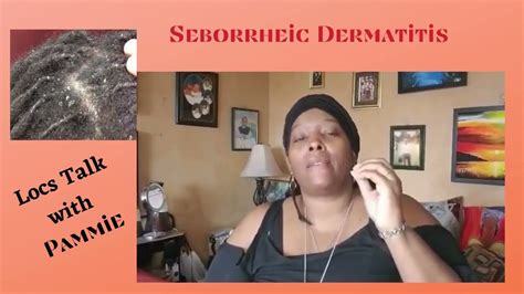 Tips To Treat And Prevent Seborrheic Dermatitis Youtube