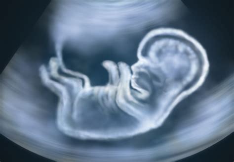 New Technology Can Keep An Eye On Babies Movements In The Womb