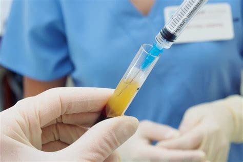 What Is Prp Treatment What Is Prp Therapy Prp Injection Md