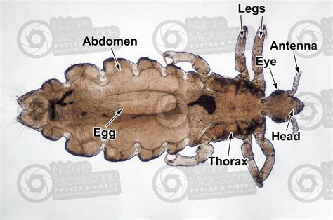 Pediculus Humanus Capitis Head Louse Pediculosis Dorsal View Lice