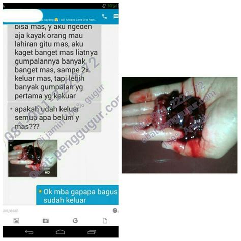 Hal ini mungkin mudah jika ubat yang diberikan hanya satu atau dua. Jual Obat Penggugur Kandungan | Obat Pelancar Haid ...