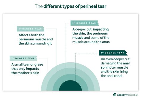 Perineum Minor Tear