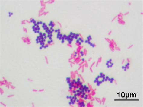 Peptidoglycan The Bacterial Wonder Wall Scientific American Blog