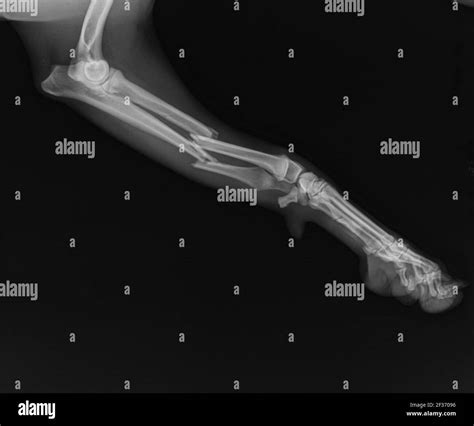 Dog X Ray Showing Radius And Ulna Fracture Lateral View Stock Photo