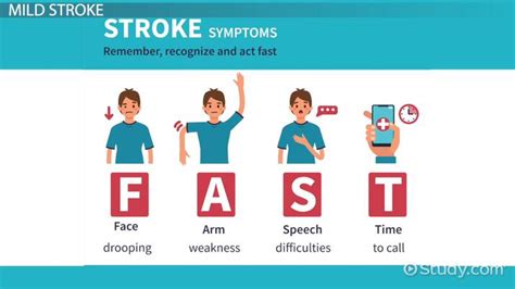 Mild Stroke Treatment And Recovery Lesson
