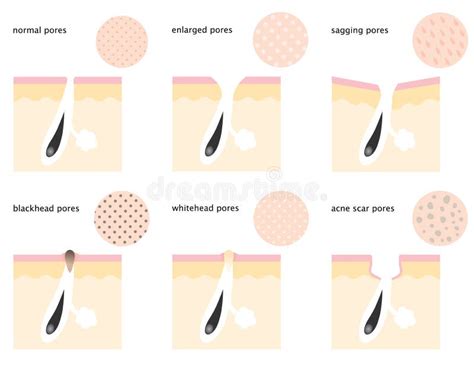 Pores Stock Illustrations Vecteurs And Clipart 847 Stock Illustrations