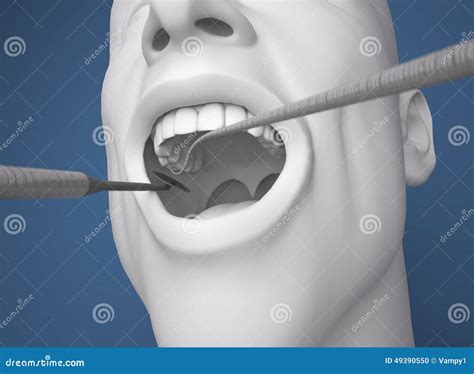 Head Mouth Open Dentist Preparation Tool Stock Illustration Image