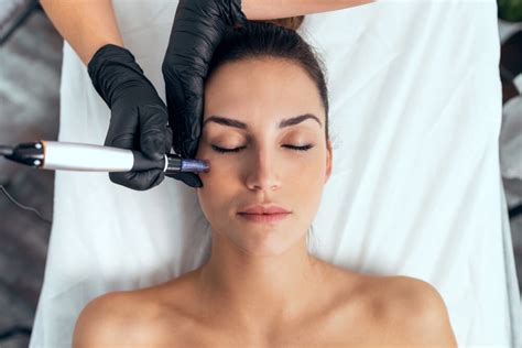 Everything You Ever Wanted To Know About Microneedling Womens Care Of Bradenton