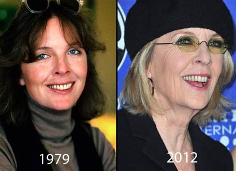 Diane Keaton Plastic Surgery Before And After Celeb Surgerycom