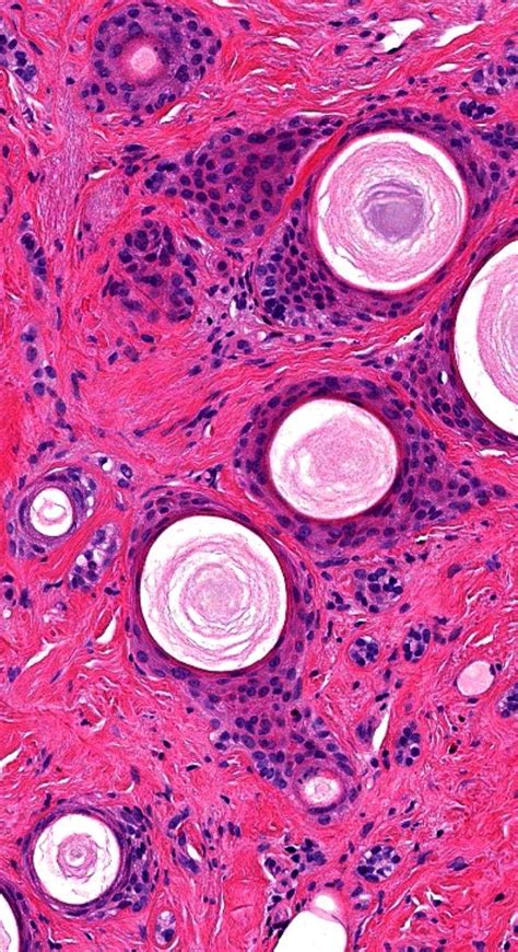 Biology Art Microscopic Images A Level Art Blood Cells Pathology