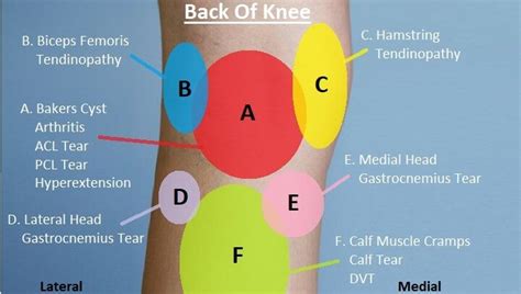 Pain at the back of the knee is known as posterior knee pain. Pin on Knee pain diagnosis