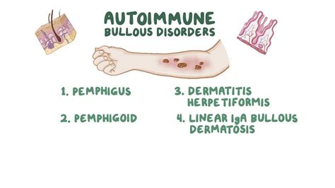 Autoimmune Bullous Skin Disorders Clinical Practice Osmosis