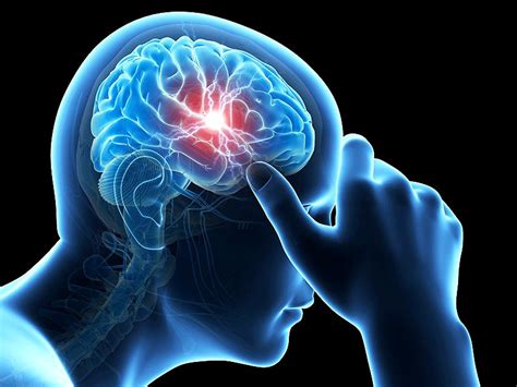 New Study Urges Concussion Patients To Get Moving Eastmount Chiropractic
