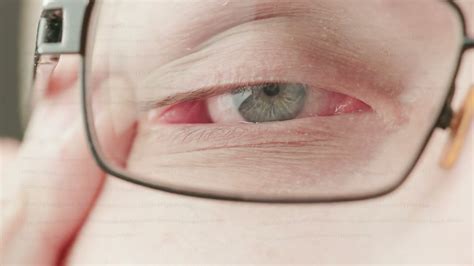 Gray Eye Of Middle Age Caucasian Male With Diopter Correction Glasses
