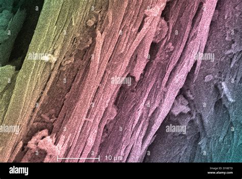 Scanning Electron Micrograph Of Asbestos 2000x Stock Photo Alamy