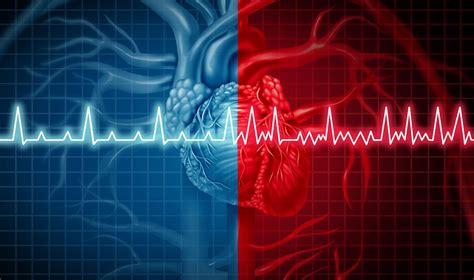 An Increased Investment In Arrhythmia Treatment