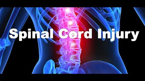 What Is A Spinal Cord Injury Youtube