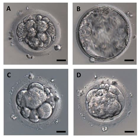 Representative Images Of Human Embryos After Thawing 0 H Ac And