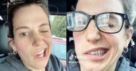 side of face numb after dentist and woman can t stop laughing