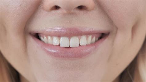 5 Ways Tooth Contouring Can Reshape Your Teeth Tompkins Dental