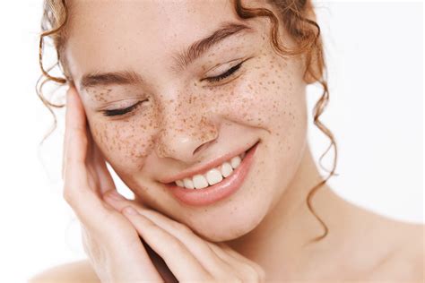 Freckles And Treatments Skin Md Laser And Cosmetic Group