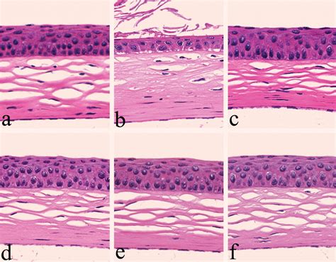 Corneal Epithelium Meddic