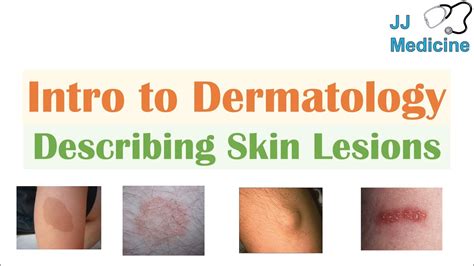 introduction to dermatology the basics describing skin lesions primary and secondary
