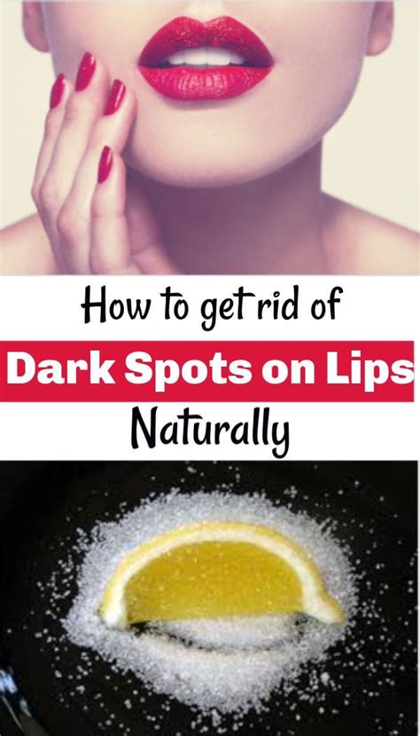 Im fall von akne ist grüner tee immens helfen gefunden worden. Dark spot on lip - Best Home Remedies To Erase Black Spots On Lips - #Black #Dark #dar… | Braune ...