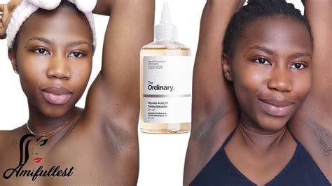 The Ordinary Glycolic Acid Toning Solution To Lighten And Get Rid Of Dark Armpits Youtube