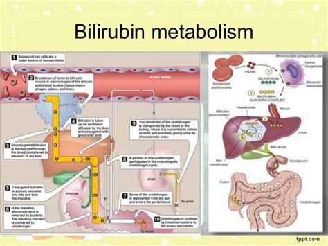 Bilirubin Metabolism In The Newborn Dr Trynaadh