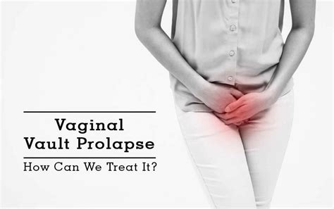 What S A Vaginal Pelvic Prolapse How Can Physiotherapy Help
