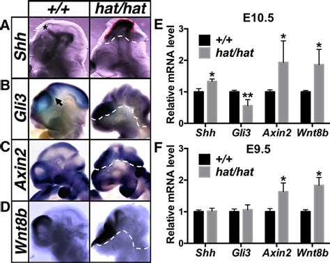 Gcn5 Hathat Mutants At E105 Display Aberrant Expression Of Genes