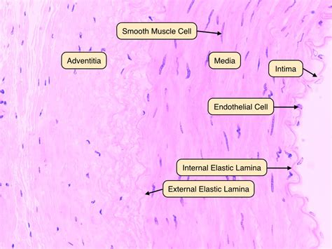 Blood vessels can be damaged by the effects of high blood glucose levels and this can in. Artery Microscope Slide Labeled - Micropedia