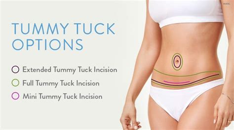Mini Tummy Tuck Vs Full Tummy Tuck Choosing The Right Procedure
