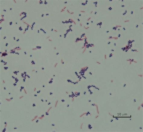 Staphylococcus Epidermidis Endospore Stain