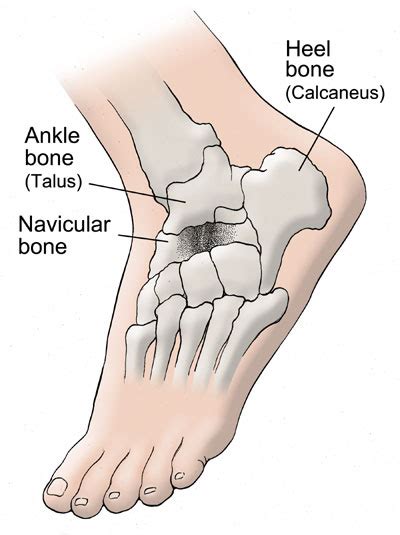 Accessory Navicular Bone Running
