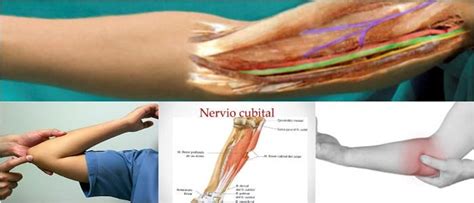 Nervio Cubital Qué es Estructura Función Significación Clínica y