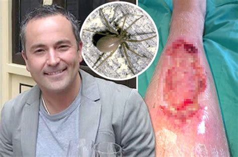 Man Just Survives Brown Recluse Spider Bite On Doha To Cape Town Flight