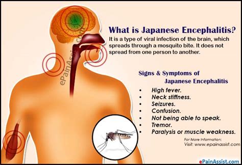 Japanese Encephalitissignssymptomstreatmentprognosisprevention