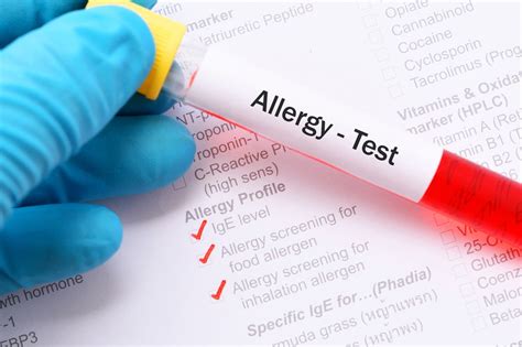 Common Types Of Allergy Tests