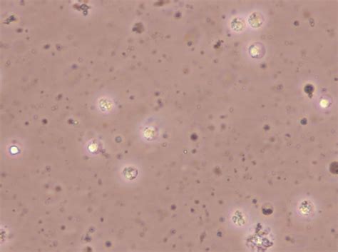 Gibco® cell culture basics, lifetechnologies.com/cellculturebasicsgood cell culture practices dictate that animal cells be grown without. working: cell culture contamination-black spot swimming