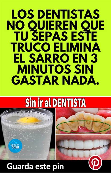 Los Dentistas No Quieren Que Tu Sepas Este Truco Elimina El Sarro En