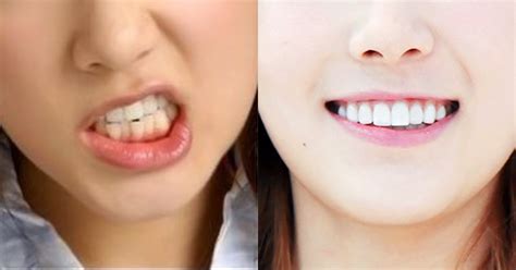 Bae Suzy Teeth Korean Idol