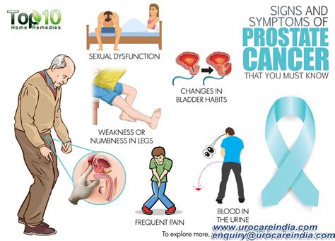 Prostate Cancer Surgery Treatment In India Prostate Cancer What Every