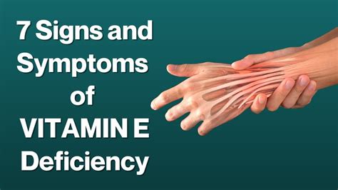 7 Signs And Symptoms Of Vitamin E Deficiency Visitjoy Youtube