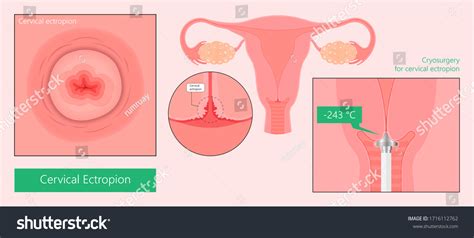Loop Pregnancy Images Stock Photos Vectors Shutterstock