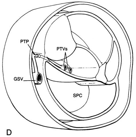 Surgical Anatomy For Endoscopic Subfascial Division Of Perforating